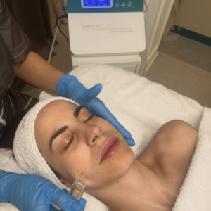 HydroDiamond microdermoabrasión
