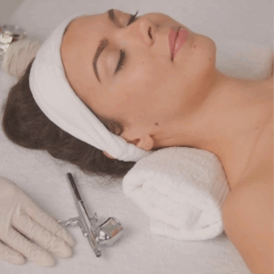 oxigenoterapia facial