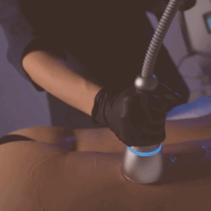 crioterapia corporal en barcelona