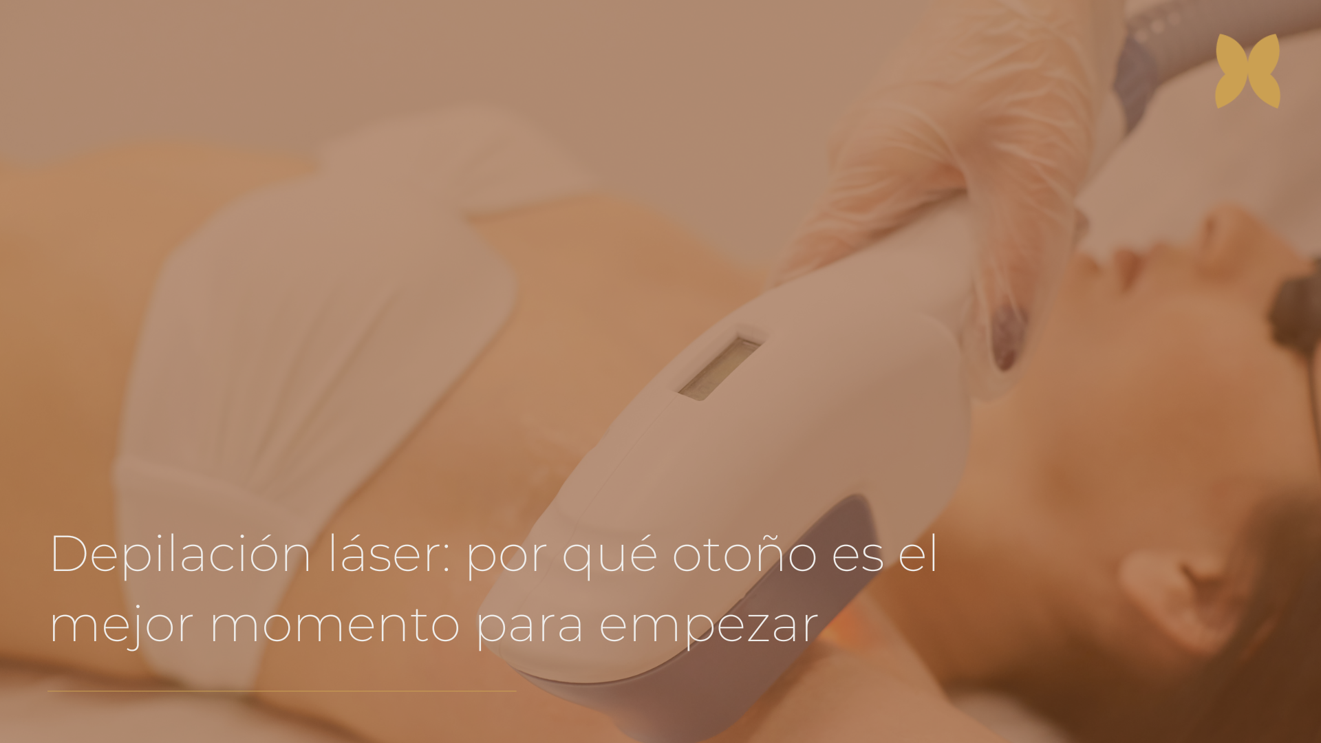depilación laser mejor momento para empezar